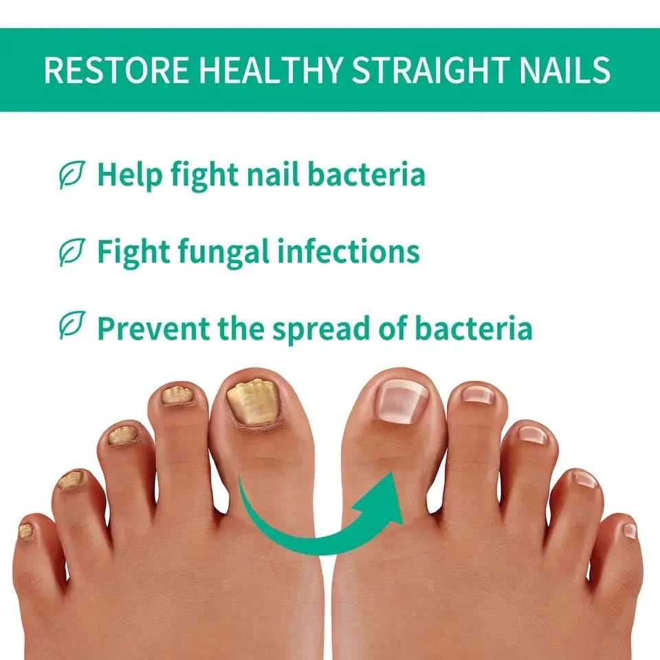 Nail Fungus Treatments Serum