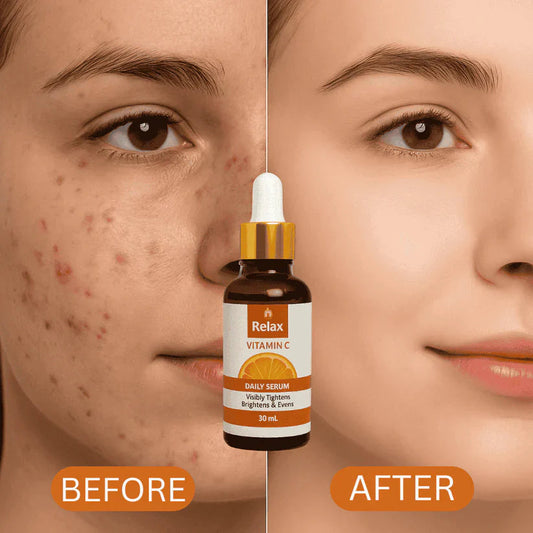 RELAX | FACE SERUM 30ML (VITAMIN C)